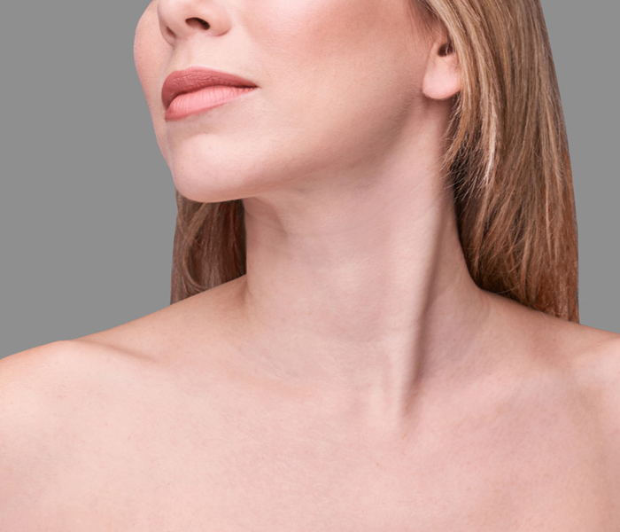 Çene Altı Yağlanmasına Kalıcı Çözüm - Gıdı Liposuction